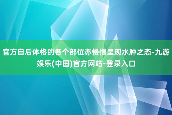 官方自后体格的各个部位亦慢慢呈现水肿之态-九游娱乐(中国)官方网站-登录入口